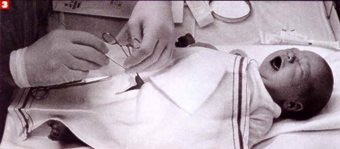 Hospital Circumcision3.jpg (19 KB)