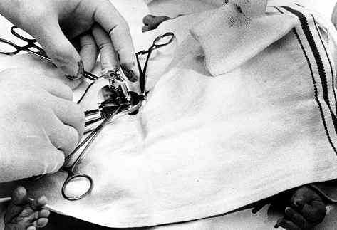 Hospital Circumcision4.jpg (16 KB)