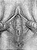 circfemale1.gif (34953 bytes)