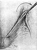 circfemale2.gif (34353 bytes)
